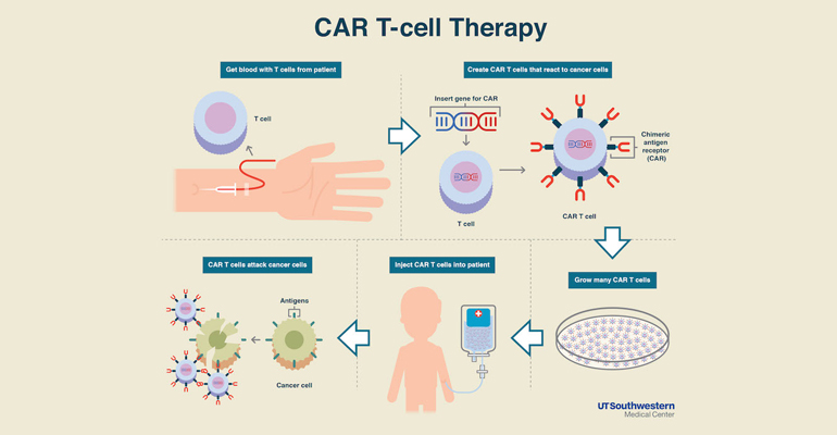 car-t-cell-therapy