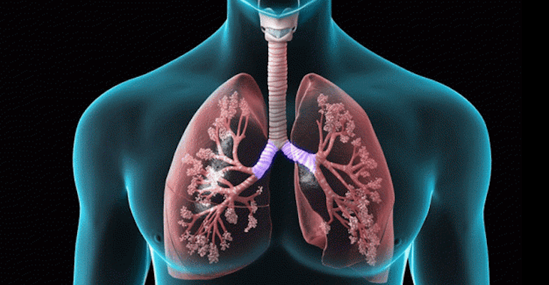 Spitalul de Pneumoftiziologie Sibiu: Bolile pulmonare care scapă diagnosticului – cum ajung pacienții prea târziu la medic