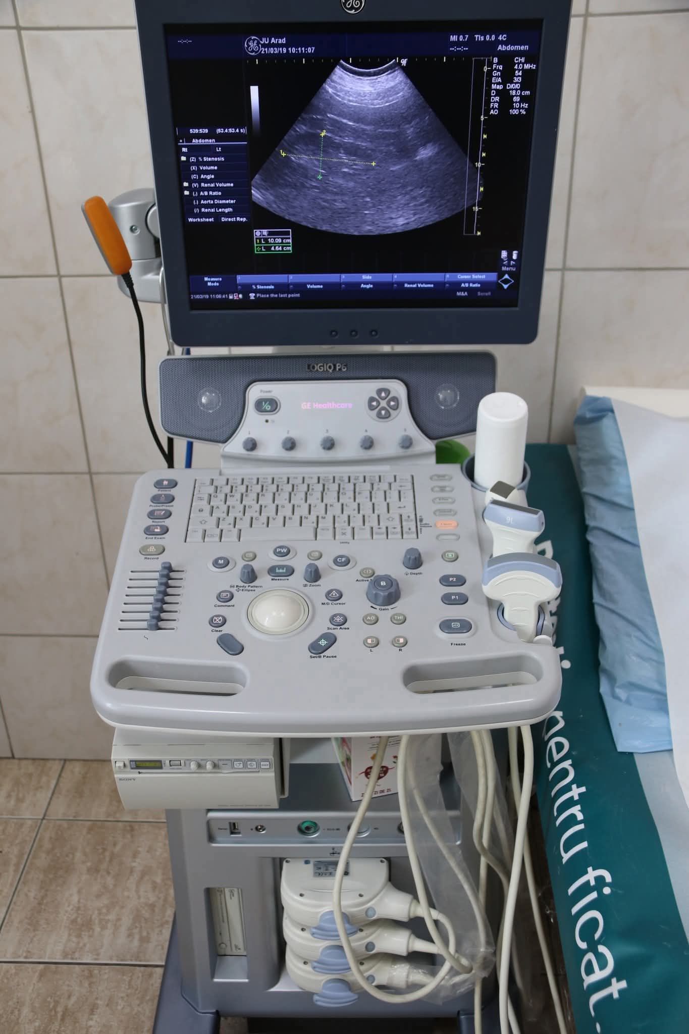 Arad: Ecografia abdominală disponibilă gratuit în cadrul ambulatoriului Spitalului Clinic Județean de Urgență