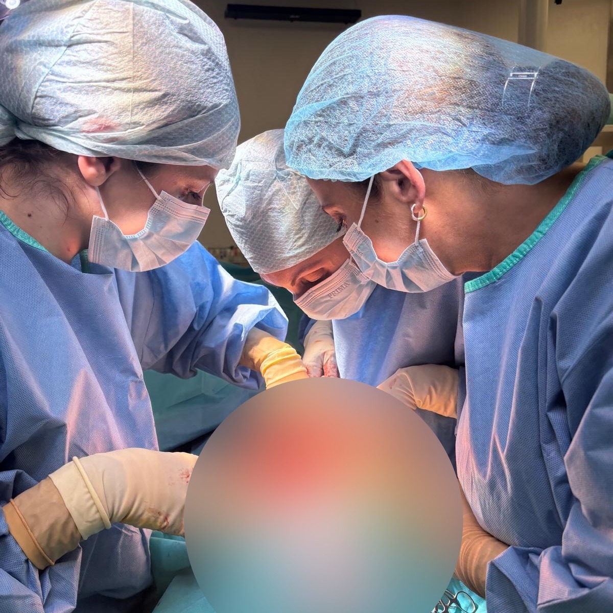 Spitalul Sf. Constantin: Intervenție chirurgicală pentru compresia nervului sciatic, cu recuperare rapidă postoperatorie