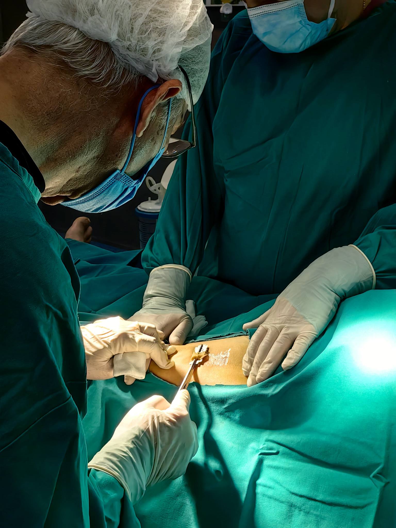 Caz ortopedic grav cu infecție severă, tratat cu succes prin intervenții chirurgicale și reconstrucție osoasă și tegumentară la Spitalul „Prof. Dr. Eduard Apetrei” din Buhuși