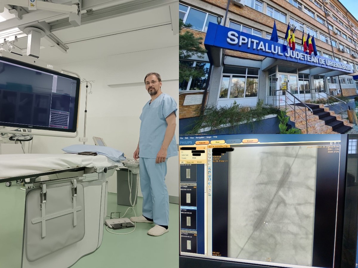 SJU Buzău realizează o intervenție în premieră pentru tratarea unei ocluzii arteriale complexe
