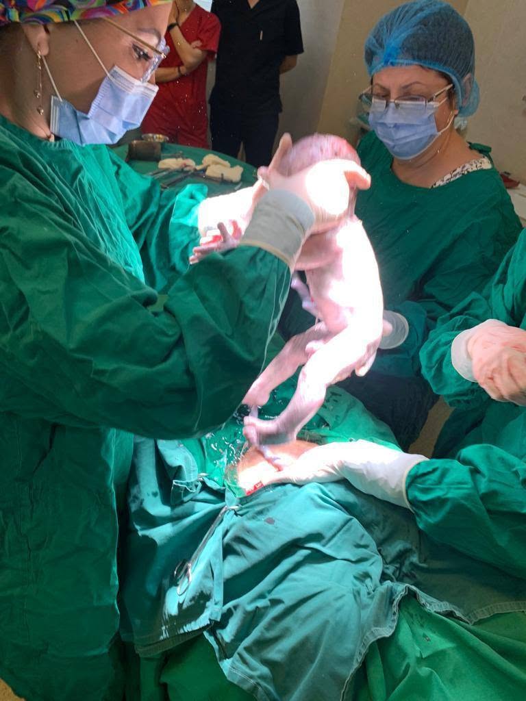 SCJU Sibiu: Semnele care indică prezentarea la maternitate și indicațiile pentru operația cezariană