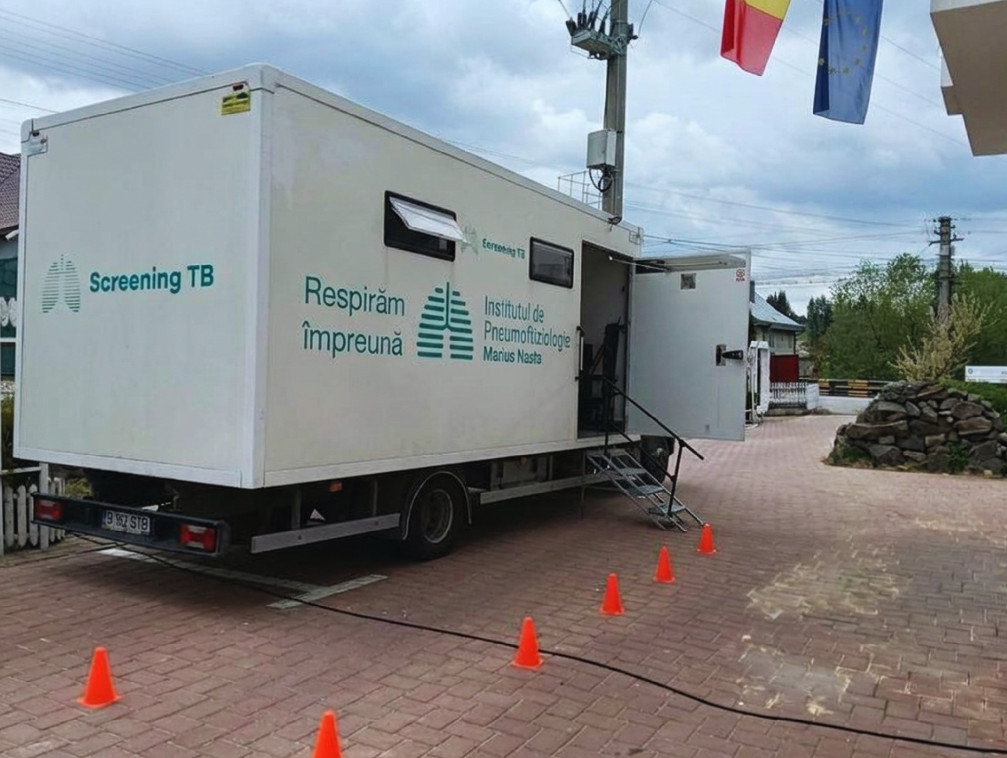 Tulcea: Screening gratuit pentru tuberculoză în 20 de localități, începând cu 4 iunie