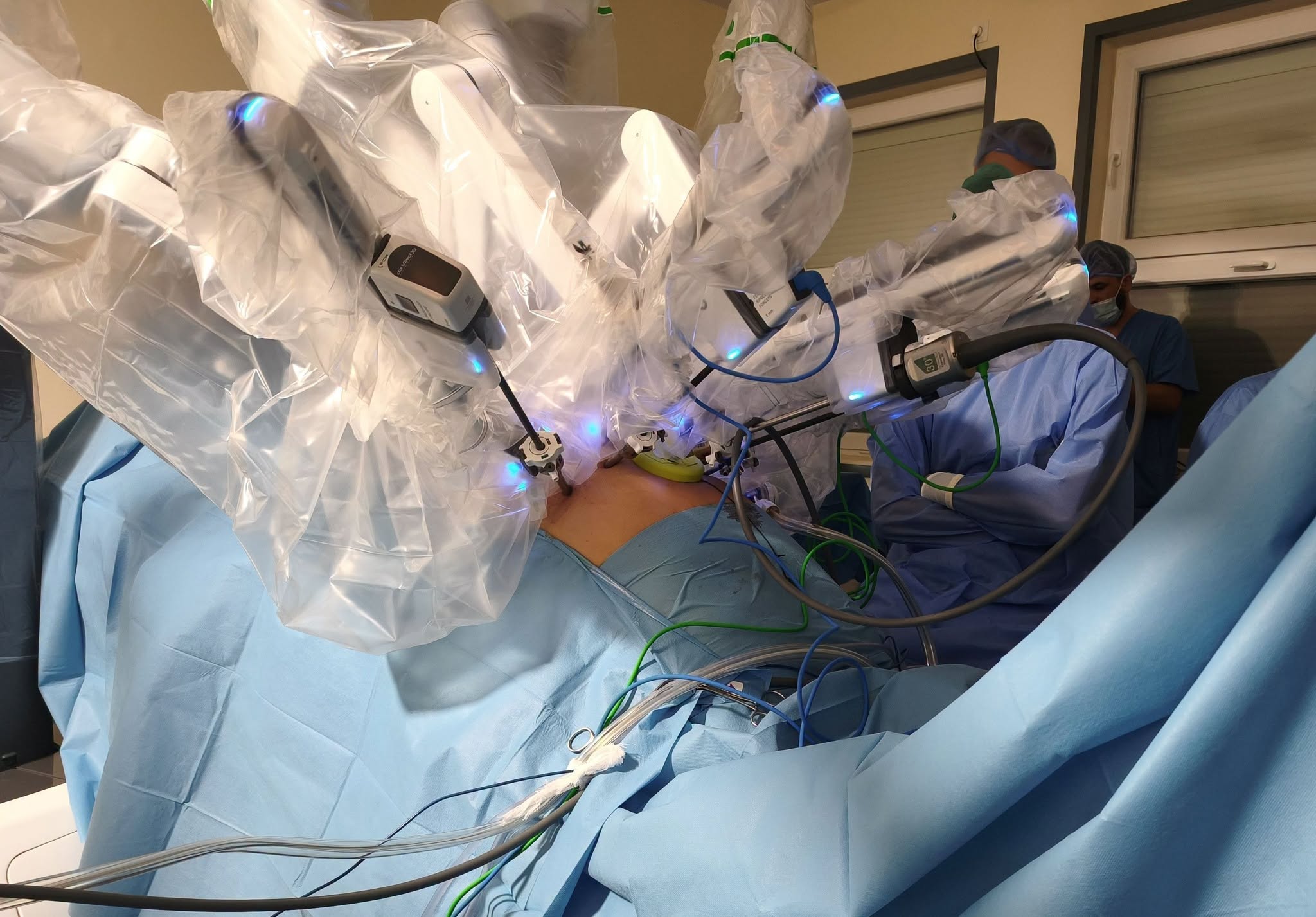 Primele prostatectomii radicale asistate robotic, realizate cu succes la Spitalul Județean de Urgență Miercurea Ciuc