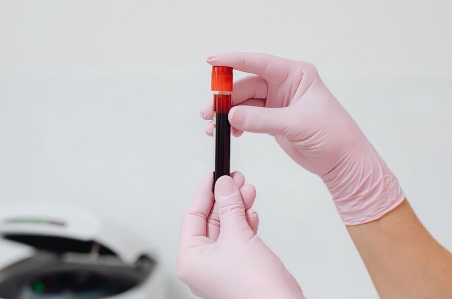 Anual, la data de 22 septembrie, este marcată ziua internațională de informare cu privire la leucemia mieloidă cronică