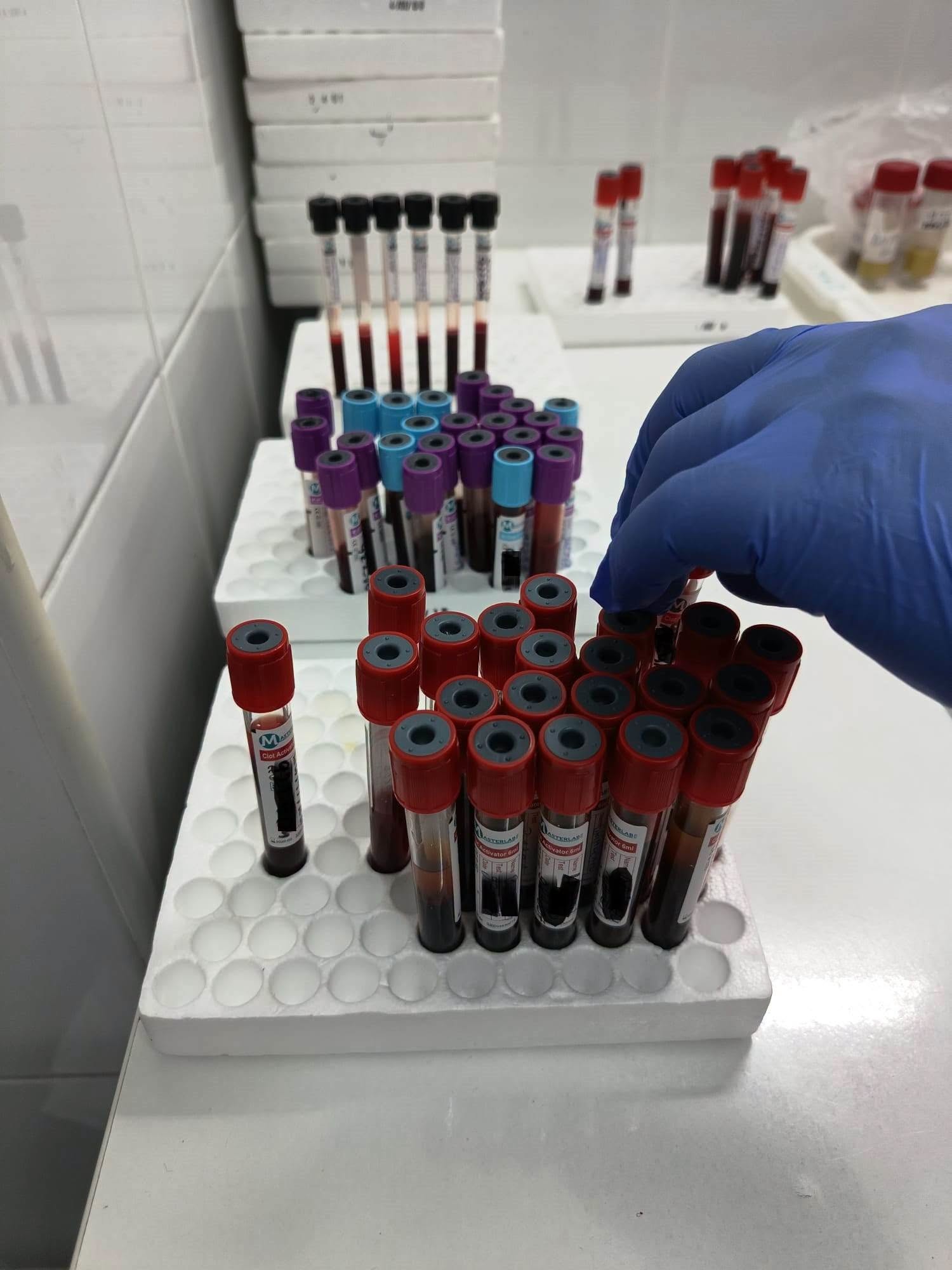 Analize medicale GRATUITE prin CAS Gorj la Spitalul Județean de Urgență Târgu-Jiu