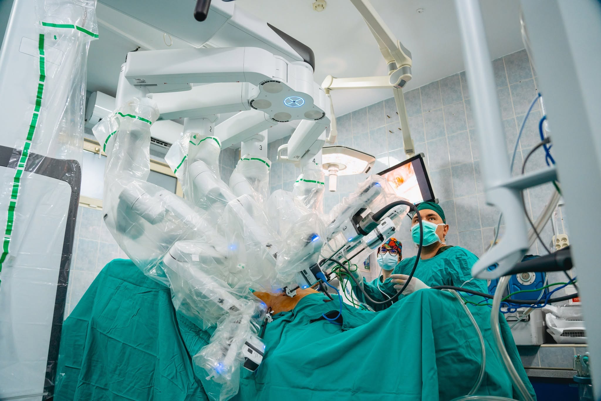 Institutul Oncologic „Prof. Dr. Ion Chiricuță” din Cluj-Napoca a realizat cea de-a 100-a intervenție chirurgicală asistată robotic
