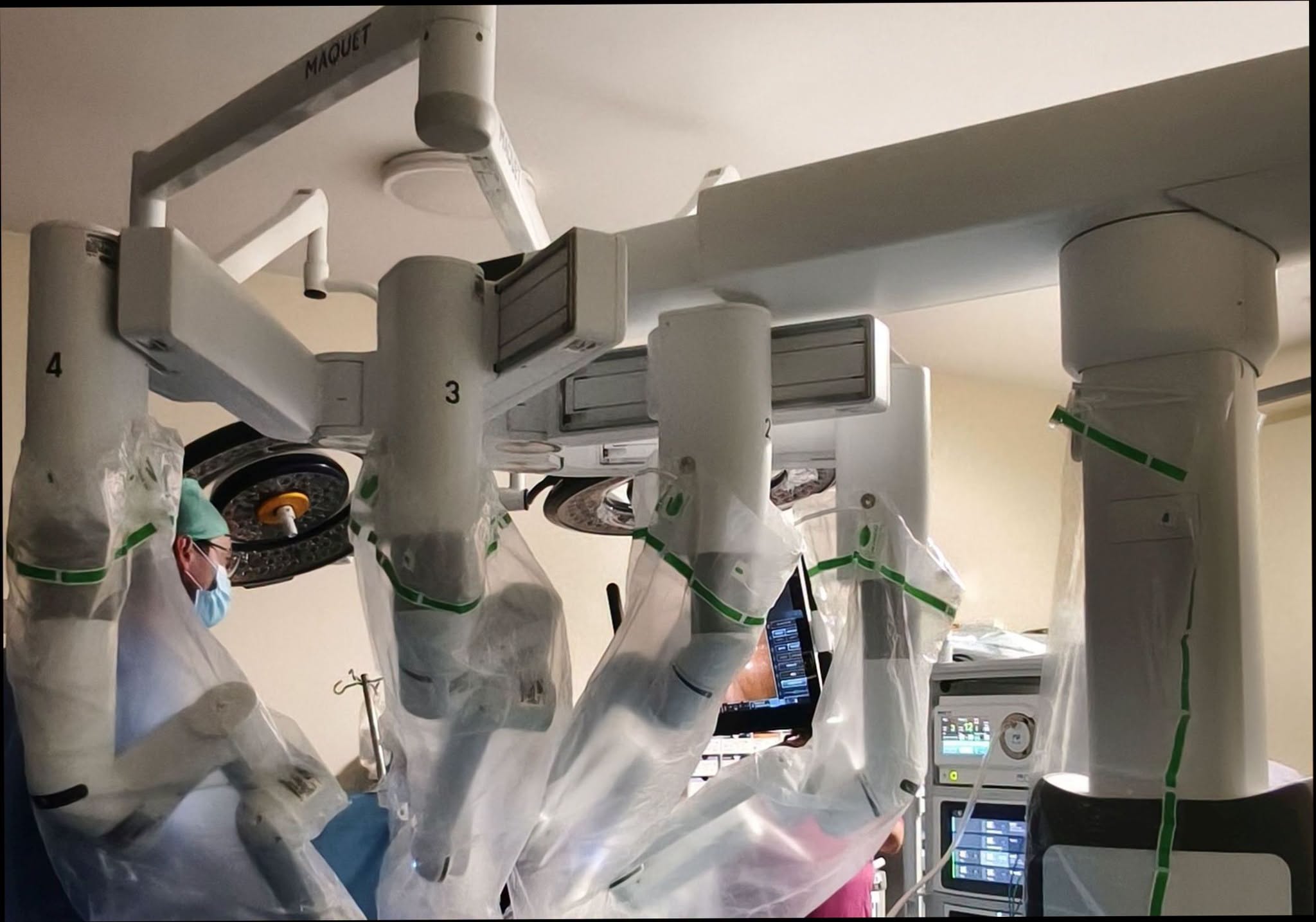 Spitalul Județean de Urgență Miercurea Ciuc, inclus în programul național de finanțare a chirurgiei robotice